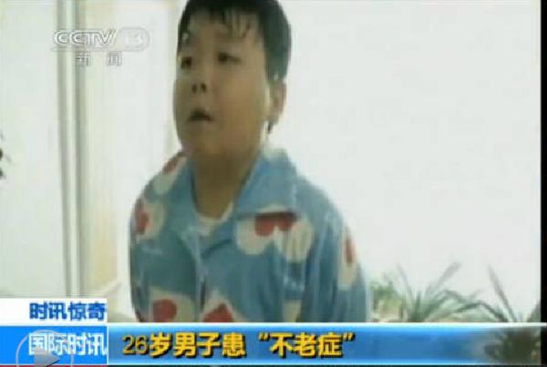 医生表示，申孝明除了外表跟一般成人不同外，身体的各项机能都十分正常，目前还找不出他停止长大的原因，也没有药物可以医治。