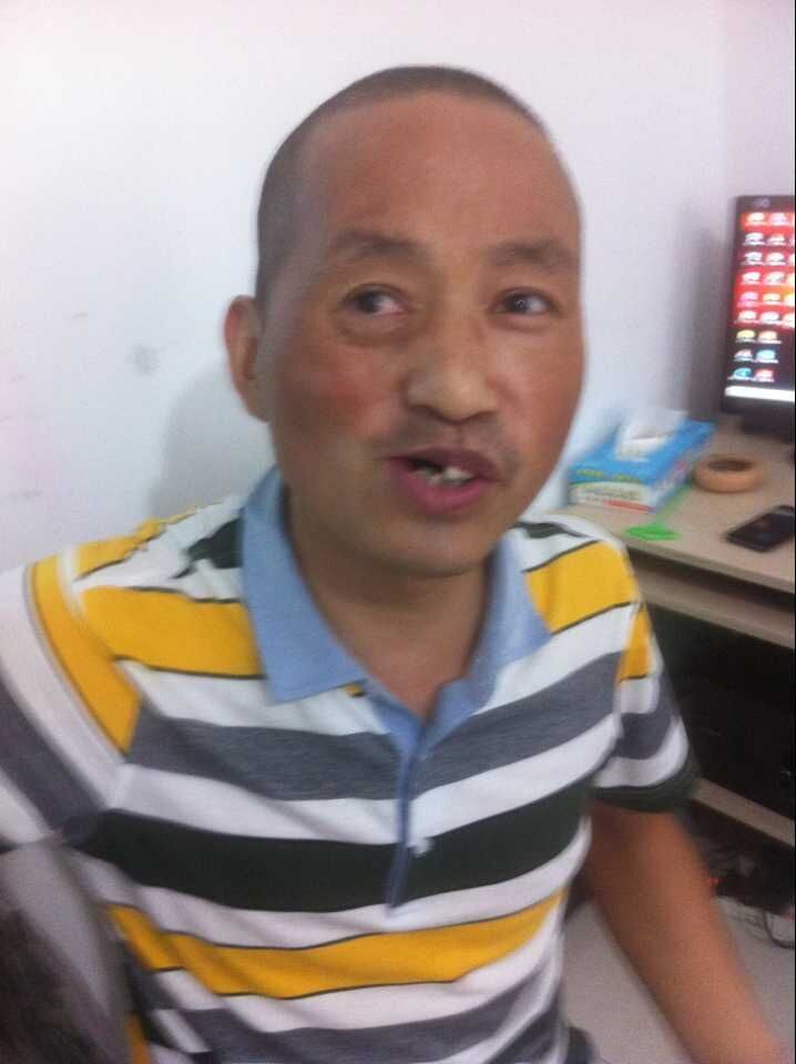 \