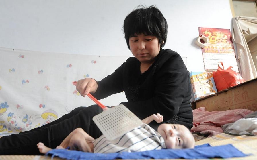 山西无肛男婴生命垂危 骨瘦如柴形似“外星人”